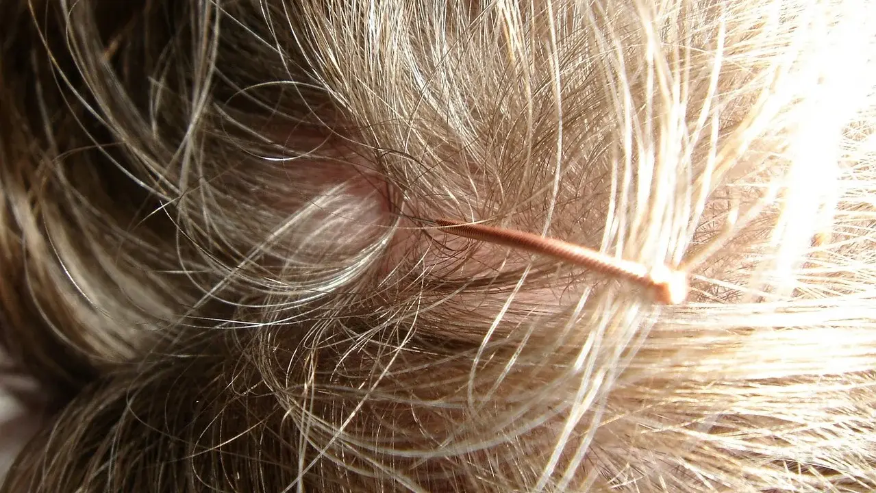 Nahaufnahme einer Kopfhaut mit feinen Haaren. Ein dünner, kupferfarbener Gegenstand liegt auf der Haut. Was tun bei juckender Kopfhaut?
