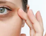 Nahaufnahme eines Auges mit sichtbaren Augenringen. Ein Finger berührt sanft die Haut unter dem Auge, als würde man zeigen, wie schminke ich augenringe weg.