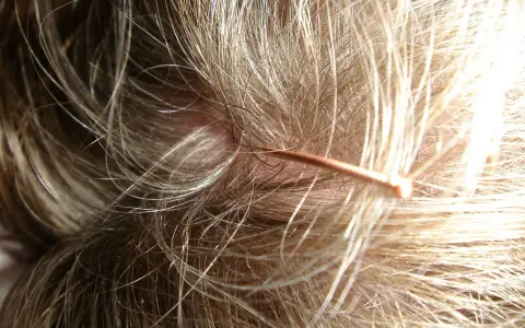 Nahaufnahme einer Kopfhaut mit feinen Haaren. Ein dünner, kupferfarbener Gegenstand liegt auf der Haut. Was tun bei juckender Kopfhaut?